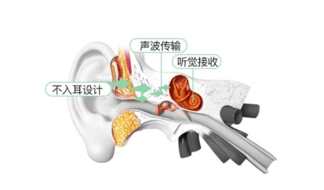 耳骨耳机有哪些缺点(十大骨传导耳机品牌测评)