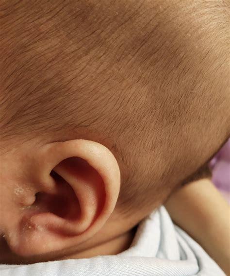 宝宝耳朵里面有东西怎么弄出来(48天宝宝喉咙有痰怎么弄出来)